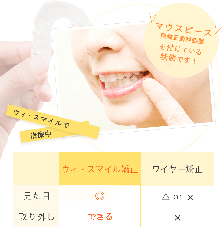 ウィ・スマイル矯正とワイヤー矯正の比較